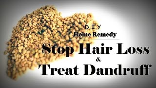 How To Stop Hair Loss and Treat Dandruff At Home Treatment and make hair grow long really fast [upl. by Ailliw]