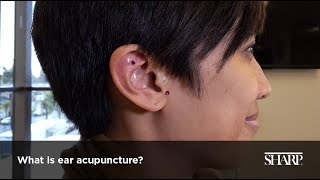 What Is Ear Acupuncture [upl. by Amal]