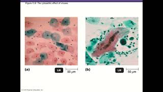 BIO 220 Chapter 13  Viruses Prions Viroids [upl. by Uzzi546]