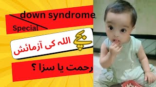 special down syndrome bichy Allah ki rehmt ya szadown syndrome girl SmilewithUnaisa [upl. by Gilud674]