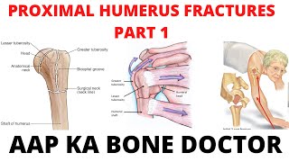 PROXIMAL HUMERUS FRACTURES  PART 1 EPISODE 9 [upl. by Geaghan]