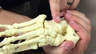 MidFoot midtarsal Examination [upl. by Kiersten]