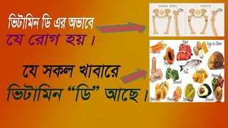 Vitamin d jukto khabar  vitamin d food list in bangla  vitamin d  vitamin d3  vitamin d food [upl. by Linad]