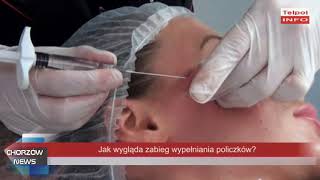 Jak się wypełnia policzki [upl. by Nawk]