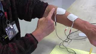 Stroke Rehabilitation Use of electrical stimulation to help arm and hand recovery [upl. by Latsirk]