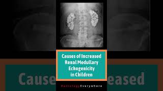 Renal Medullary Echogenicity  Medullary nephrocalcinosis  Radiology  causes  video 47  Shorts [upl. by Imit]