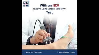 Get an accurate NCV Test done at Quadra [upl. by Assenahs389]