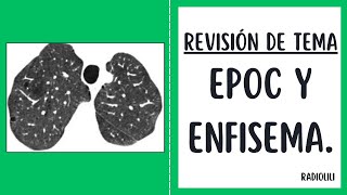 Revisión de Tema 57 EPOC y enfisema [upl. by Nilok]