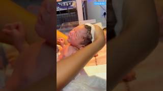 Baby care Nicumedical newbornbaby viralvideo [upl. by Marquez]