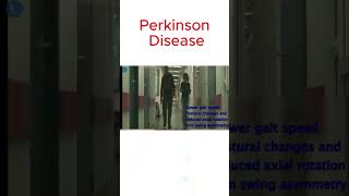 Gait impairment in Parkinson [upl. by Samuele885]