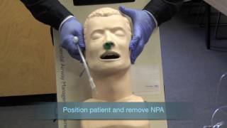 Nasotracheal Intubation [upl. by Edahc229]