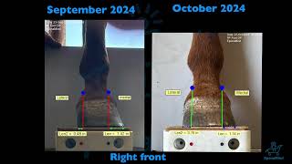 Trimming for Correct MedialLateral Balance  Update 2 [upl. by Clarie]