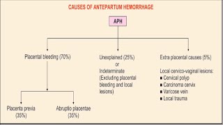 ANTEPARTUM HEMORRHAGE [upl. by Liu594]