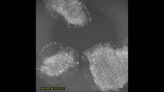 Human iPSC Differentiation [upl. by Imak]