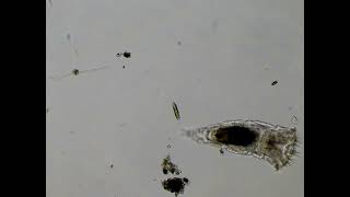 Diatom Becomes a Snack for a Rotifer [upl. by Onstad289]