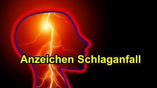 Apoplex Anzeichen Schlaganfall 2021 [upl. by Ahtanaram]