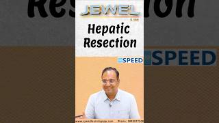 Hepatic Resection by DrKVinayak Senthil neetss iniss medico neetpg [upl. by Samot]