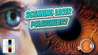 Scanning laser polarimetry Your EYEBALLS 👁️👁️💉😳💊🔊💯✅ [upl. by Samale820]