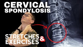 Cervical Spondylosis Neck Arthritis Stretches amp Exercises  Dr Jon Saunders [upl. by Kcinnay993]