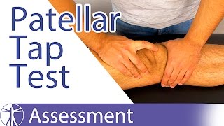 Patellar Tap Test  Ballottement Test⎟Knee Swelling [upl. by Frederigo482]