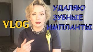 VlogПРОБЛЕМЫ С ЗУБНЫМИ ИМПЛАНТАМИОПЕРАЦИЯ №1  УДАЛЕНИЕ И ЧИСТКА [upl. by Ahsiruam83]