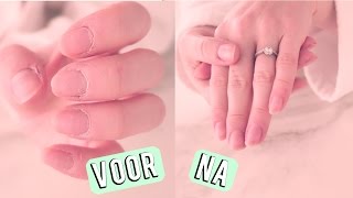 Snel droge handen en nagelriemen verzorgen  Beautygloss [upl. by Nnylsoj]