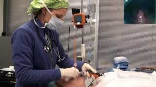 Video laryngoscope Tracheal intubation with Bougie Port [upl. by Ashwin]