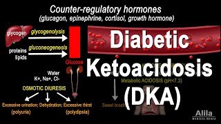 Diabetic Ketoacidosis DKA Pathophysiology Animation [upl. by Venita]