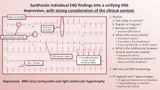 Intro to EKG Interpretation  The 5 Cardinal Rules [upl. by Metcalf906]