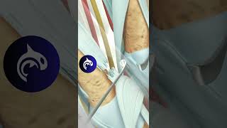 See how Extensor Tendon Injury of the Hand is and Repaired  3D Animation [upl. by Idoc]