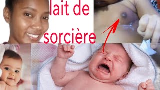 lait de sorcière chez le nouveau nébaby nurselife nouveauné laitdesorciere [upl. by Ingold]