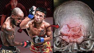 Broke His Opponents Bones The Scariest Muay Thai Fighter Ever  Rodtang Jitmuangnon [upl. by Ecienaj]