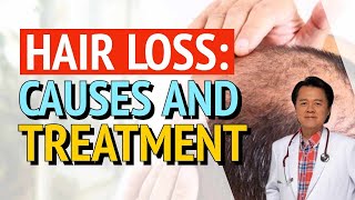 Hair Loss Causes And Treatment  By Doctor Willie Ong Internist amp Cardiologist [upl. by Towill]