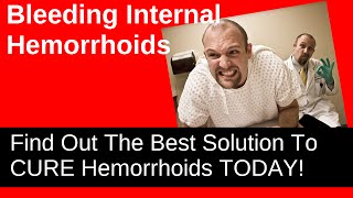 Bleeding Internal Hemorrhoids  How To Stop It [upl. by Ordnasela]