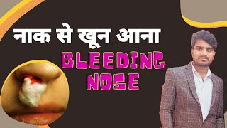 Naak Se Khun Kyu Nikalta Hai  Naak Se Blood Aana  Abhishek Kumar [upl. by Stevana]