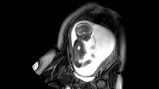 Foetal Development Unborn Baby Movement at 24 Weeks  WIRED [upl. by Annabel165]