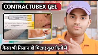 Contractubex gel uses dose benefits and side effects full review in hindi [upl. by Yeslaehc]