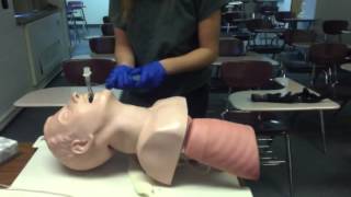 Extubation procedure [upl. by Nannahs]