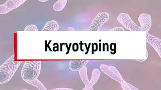 What is Karyotyping Test or Chromosomal Analysis [upl. by Annhej119]