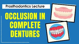 Occlusion in Complete Dentures  Prosthodontics Lecture  Dr Manase [upl. by Fidelio]