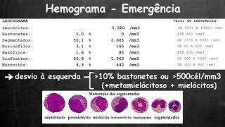 O que Significa Plaquetas baixas no sangue  Biomedicina [upl. by Hcaz]