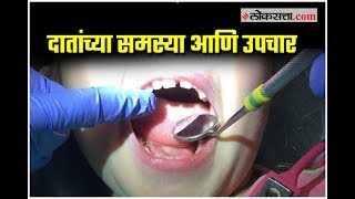 Dental Caries  दातांची कीड उपाय आणि उपचार [upl. by Unni]