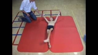 Dyskinetic cerebral palsy case 3 [upl. by Evadne]