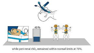 INVOS™ oximetry in the NICU Byte 9 NIRS as a signal of hypocarbiainduced cerebral vasoconstriction [upl. by Lesli]