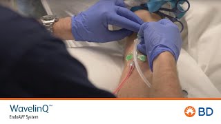 BD WavelinQ™ EndoAVF Cannulation Training [upl. by Whalen174]