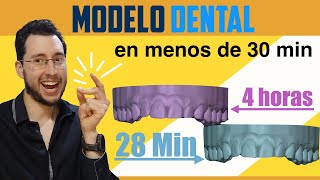 🚀 IMPRIMIR modelos dentales MUY RÁPIDO  Truco con Chitubox 👈 [upl. by Emlynn]