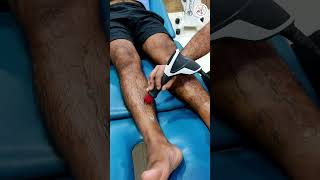 Shockwave Treatment in Lucknow chiropractor lucknow physiotherapy chiropractic motivation [upl. by Bogart]