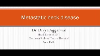 Metastatic neck disease [upl. by Ainiger]