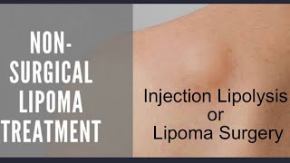 INJECTION LIPOLYSIS Vs LIPOMA REMOVAL SURGERY EXPERIENCE  RISKS amp BENEFITS DR ASHISH BHANOT [upl. by Jones]