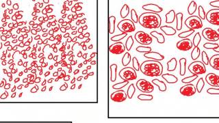 PATHOLOGY SLIDES 7 DR SAMEH GHAZY [upl. by Edeline]